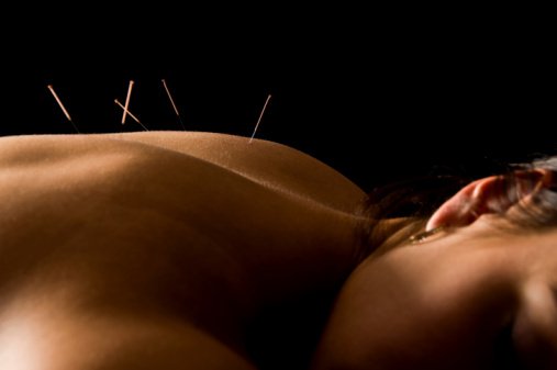 Acupuncture for Anxiety