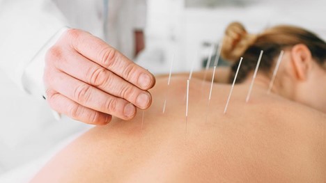 Acupuncture Clinic